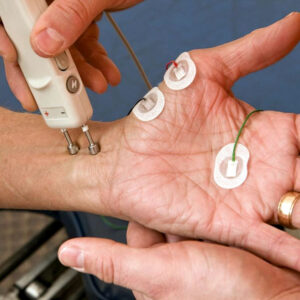 Neuromuscular Electrodiagnostics