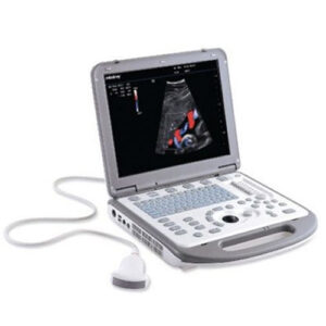 ultrasound scanning